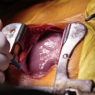 أنواع جراحات القلب