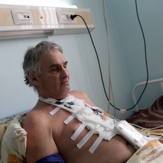 بعد إجراء عملية القلب المفتوح