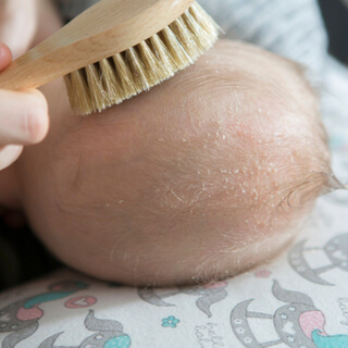 5. طاقية المهد 5. طاقية المهد