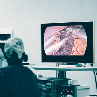 عملية التكميم باستخدام المنظار