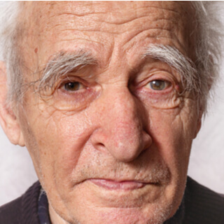 الجلوكوما بالصور الجلوكوما بالصور