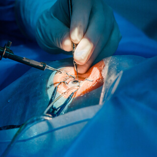 3. الجراحة 3. الجراحة