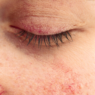 أنواع العد الوردي 