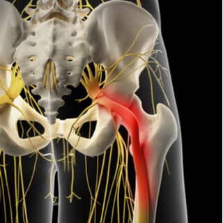 تشريح العصب الوركي