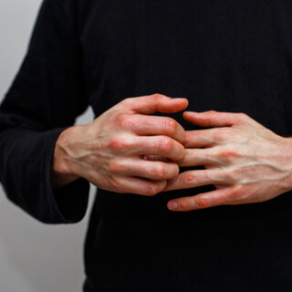 الفرق بين الإكزيما والصدفية في الأعراض