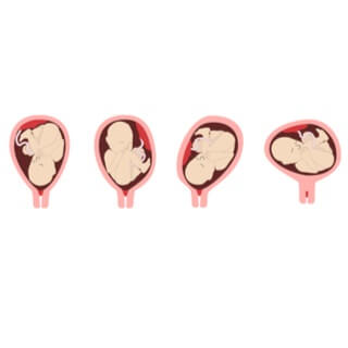 2. وضعيات الجنين غير الطبيعية 2. وضعيات الجنين غير الطبيعية