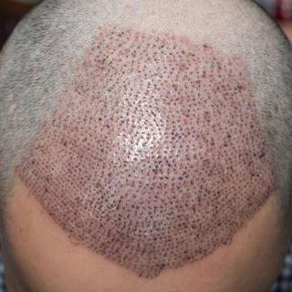 الأسابيع الثمانية الأولى بعد الزراعة