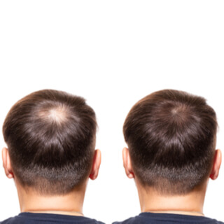 بعد مرور ستة أشهر