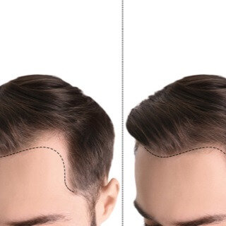 تسعة أشهر بعد الزراعة وحتى مرور سنة