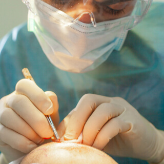  مدى نجاح عملية الزراعة