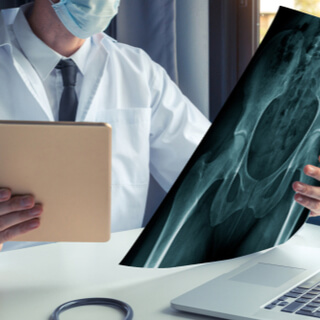 نصائح ما قبل القيام بحجامة عرق النسا 