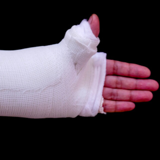 3. وصع الحشوة  3. وصع الحشوة