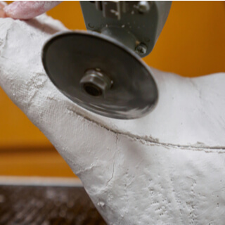 نصائح للعناية بالجبيرة نصائح للعناية بالجبيرة