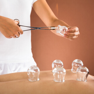 1. الحجامة الجافة