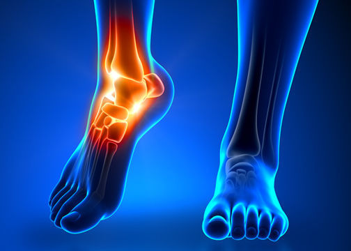 التهابات المفاصل