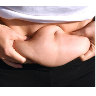 أماكن إزالة الترهلات في الجسم أماكن إزالة الترهلات في الجسم