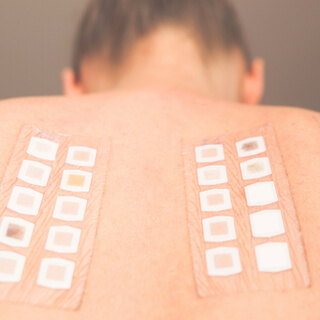 فحص رقعة الجلد 