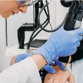 علاج الثآليل