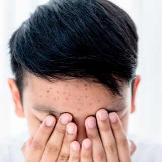 2. التعرّق وحب الشباب والشعر