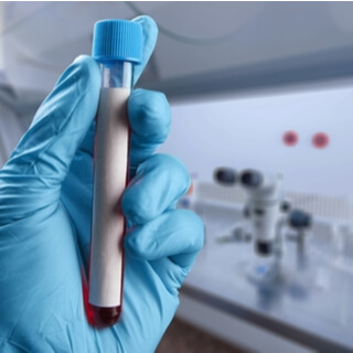 تشخيص الإصابة بفيروس hpv تشخيص الإصابة بفيروس hpv