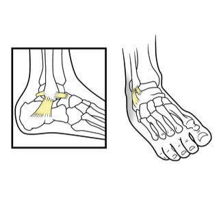 أربطة الكاحل