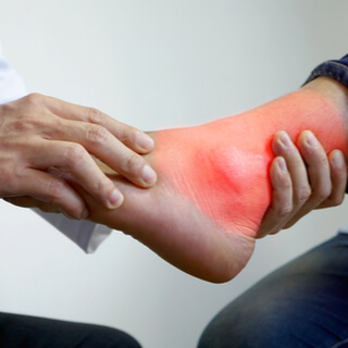 مشاكل الكاحل