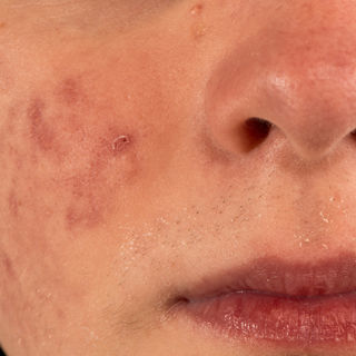 الأمراض الجلدية