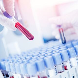 تشخيص فيروس الإيدز 