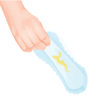 4. الإفرازات المهبلية (Vaginal Discharge)