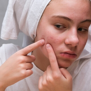 6. حب الشباب والتعرّق (Acne and Sweating)