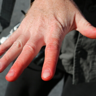 7. اضطرابات الأعصاب (Nerve Disorders)