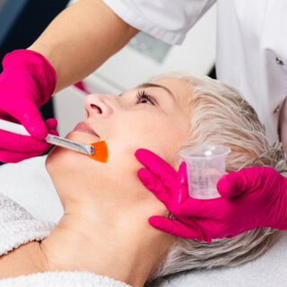 2. التقشير الكيميائي (Chemical Peel)