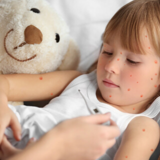 2. الأعراض  2. الأعراض