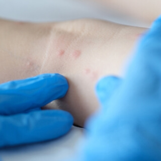 3. التشخيص 3. التشخيص