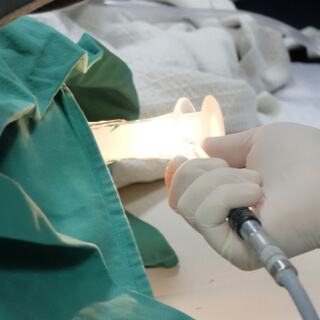 أنواع عملية البواسير