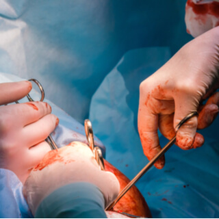 2. الجراحة التي تتطلب تخدير