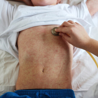 3. التشخيص 3. التشخيص