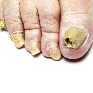 5. المضاعفات