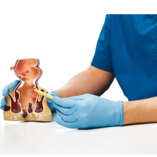 9. المستقيم وفتحة الشرج