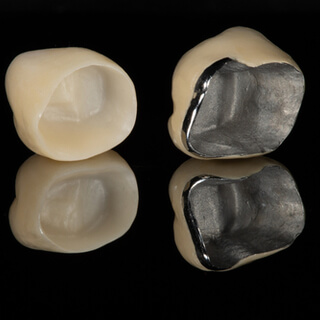 أنواع تلبيسة الأسنان