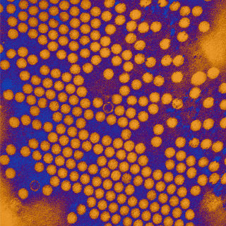 شلل الأطفال الناجم عن التطعيم