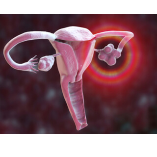 3. تغيير في موضع أو تماسك عنق الرحم (Change in cervical position or firmness)