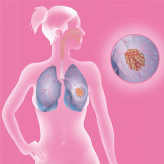 الانتماء الجنسي