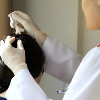 علاج أكزيما الشعر