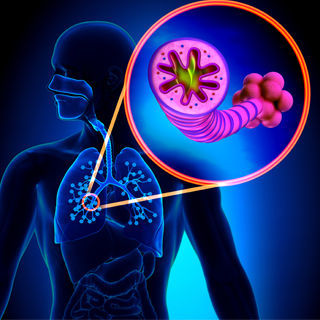 امراض الرئة السابقة