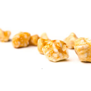 4. حصوات السيستين