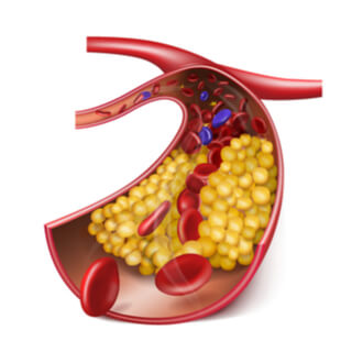 طرق لتقليل مستوى الكوليسترول المرتفع بالصور