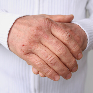 أسباب جفاف الجلد 