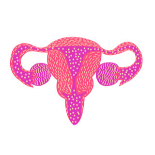 5. الرحم على شكل T