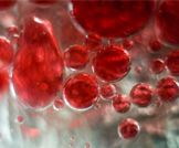 انحلال الدم الوليدي: دليلك الشامل لتعرف عليه